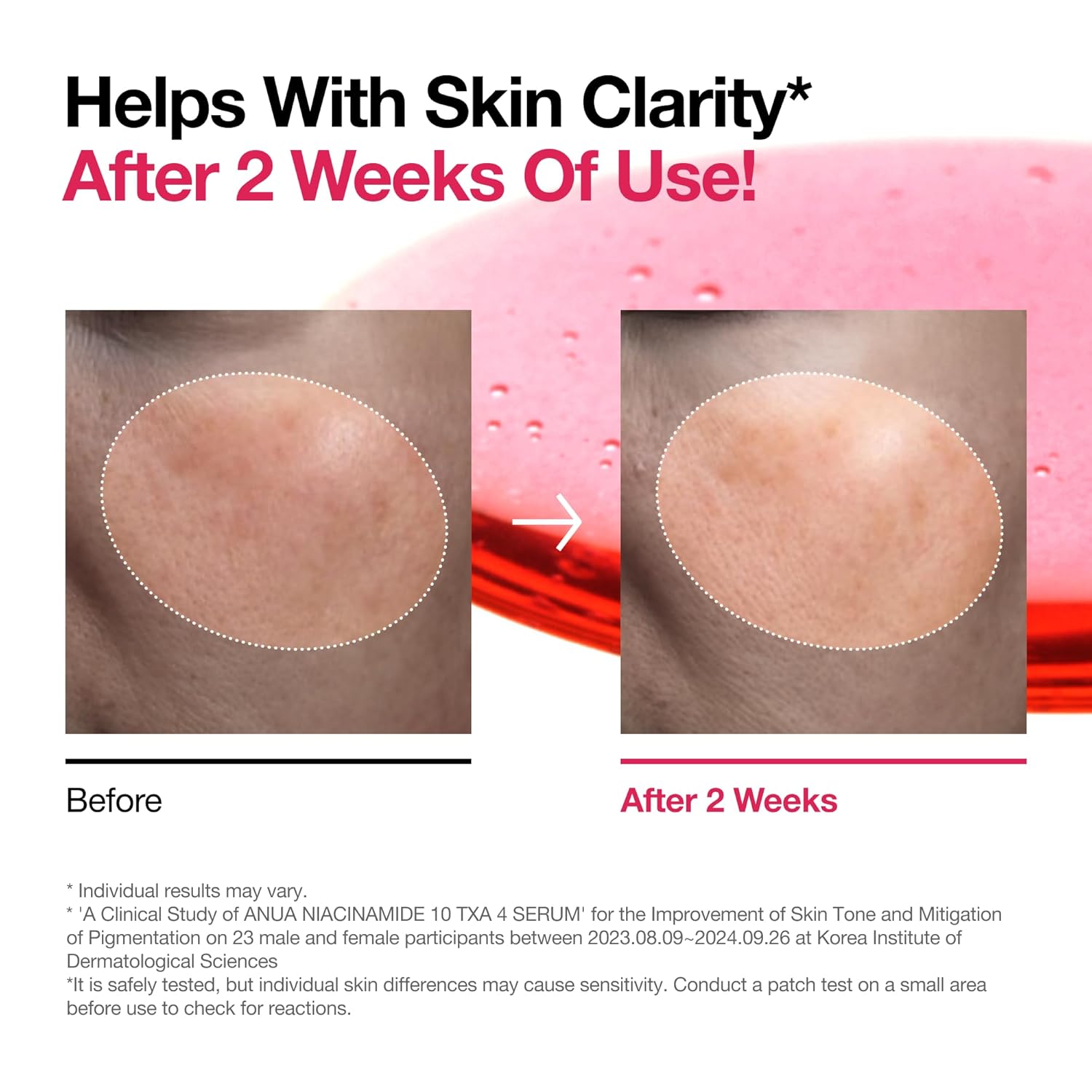 ANUA Niacinamide 10 + TXA 4 Serum (30ml/1.01 fl.oz)